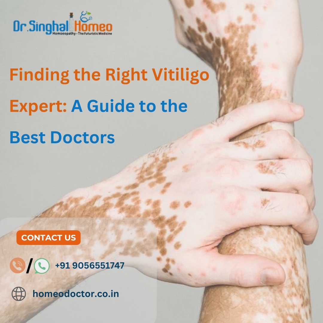 Finding Hope: The Right Doctor Makes All the Difference in Vitiligo Treatment