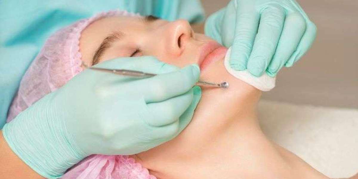 Acne Medication Market: Treatments, Providers & Patients